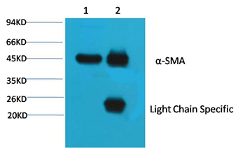 α Skeletal Muslce Actin Mouse Monoclonal Antibody(4B11)