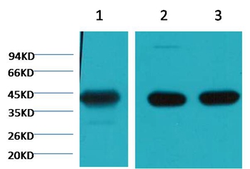 α Skeletal Muslce Actin Mouse Monoclonal Antibody(4B11)