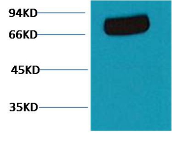 Transferrin Mouse Monoclonal Antibody(7F4)