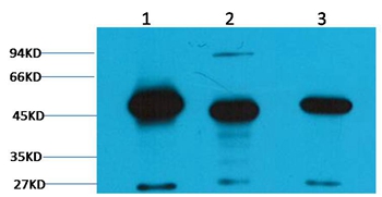 Fumarase Mouse Monoclonal Antibody(2B11)