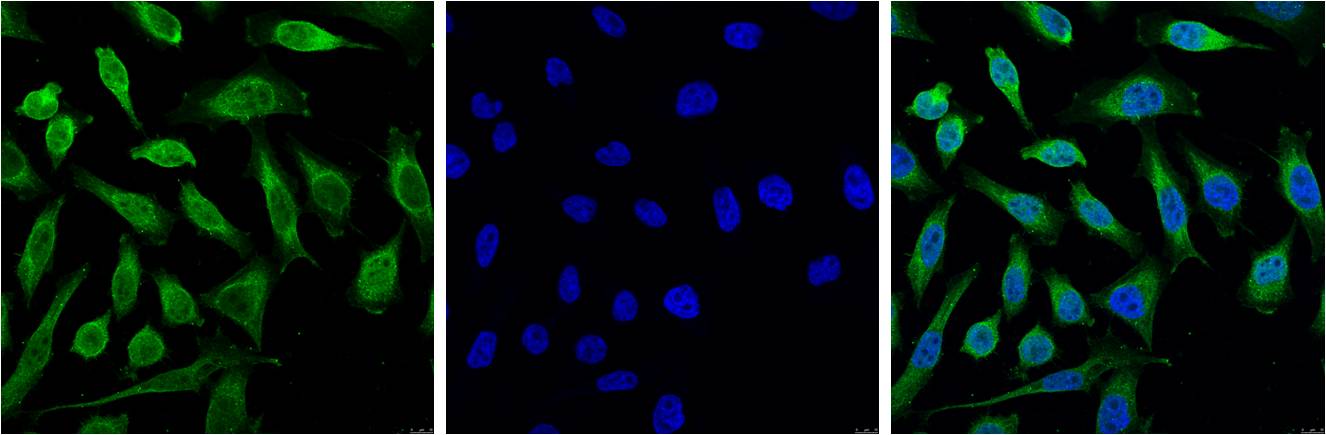 Progesterone Receptor Mouse Monoclonal Antibody(Z15)