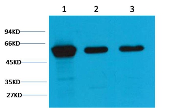 Vimentin Mouse Monoclonal Antibody(1A7)