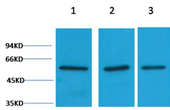 Vimentin Rabbit Polyclonal Antibody