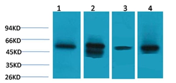 LDHD Rabbit Polyclonal Antibody