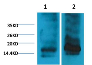 Histone H3(Tri-methyl-K9) Mouse Monoclonal Antibody