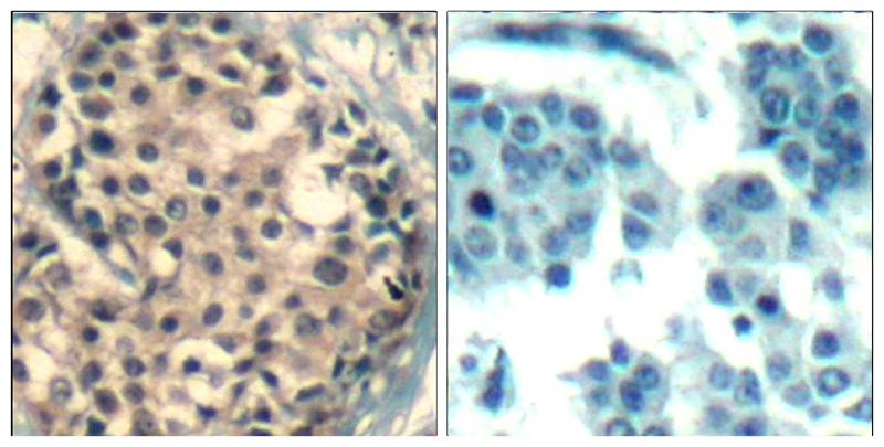 HDAC4/HDAC5/HDAC9(phospho-Ser246/259/220) Antibody