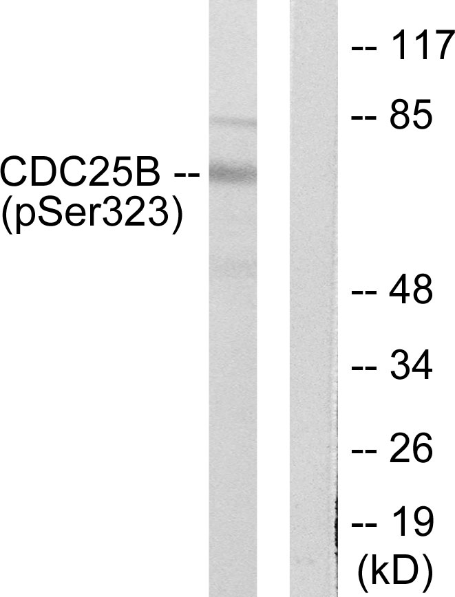 CDC25B (Phospho-Ser323) Antibody 