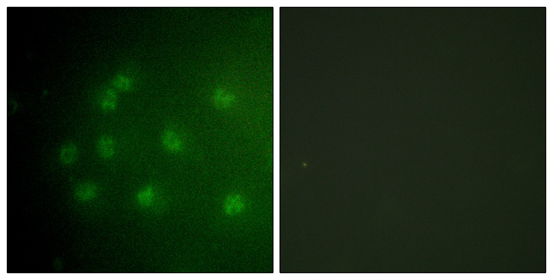 Retinoblastoma (Phospho-Thr826) Antibody