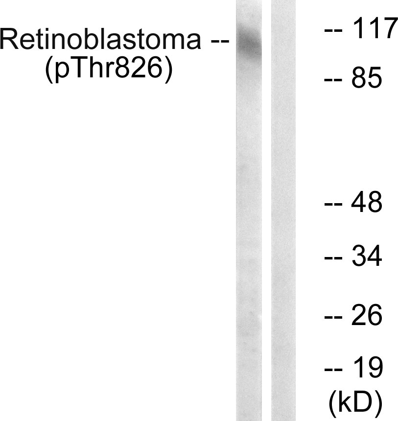 Retinoblastoma (Phospho-Thr826) Antibody