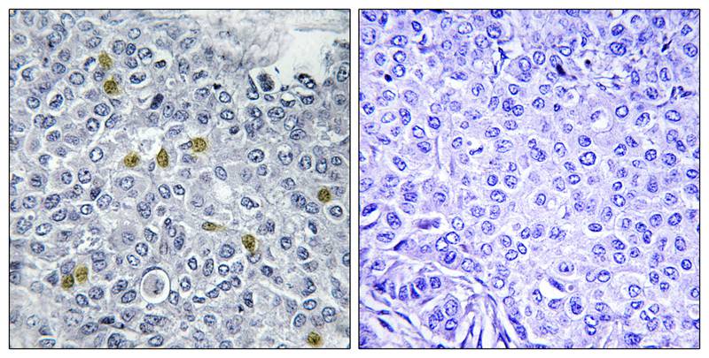 TOP2A (Phospho-Ser1106) Antibody