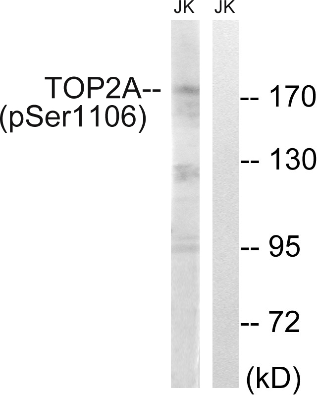 TOP2A (Phospho-Ser1106) Antibody