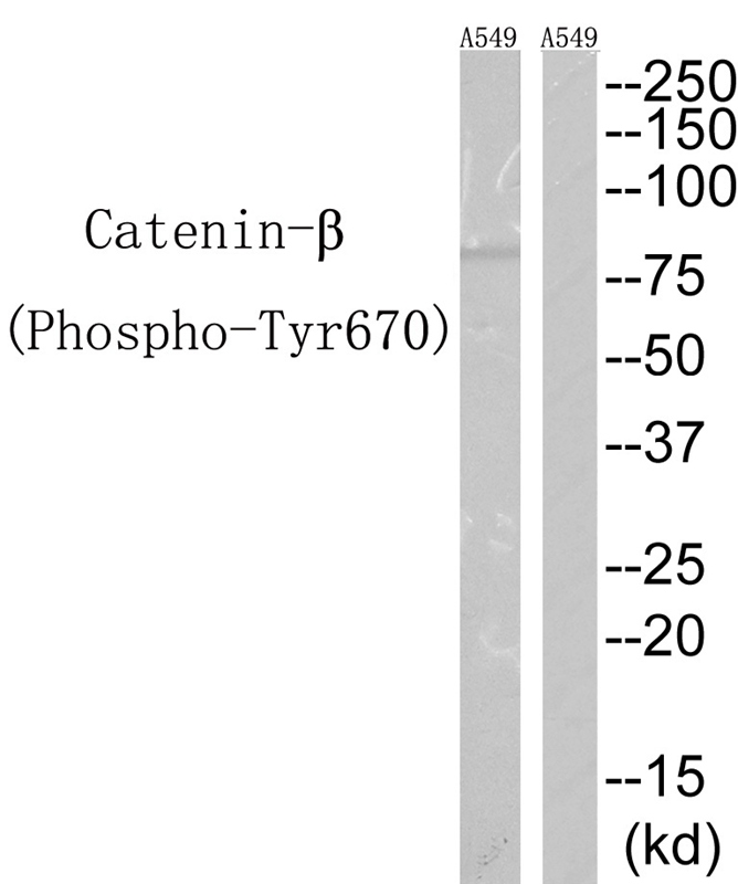 Catenin-β(Phospho-Tyr670) Antibody