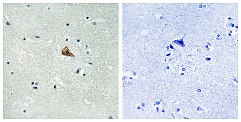 Trk A (Phospho-Tyr701) Antibody