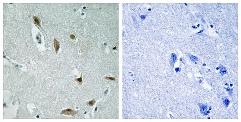 AKT1/3 (Phospho-Tyr437/434) Antibody