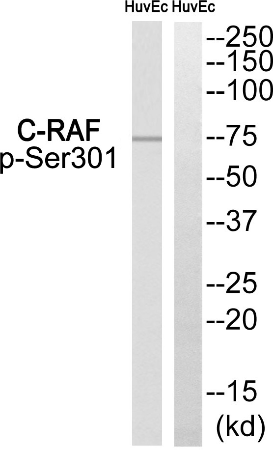 C-RAF (Phospho-Ser301) Antibody 