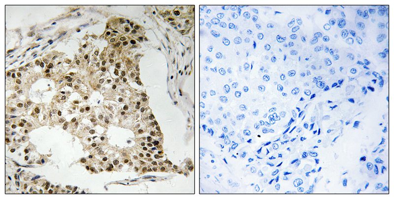 Retinoic Acid Receptor α (Phospho-Ser77) Antibody