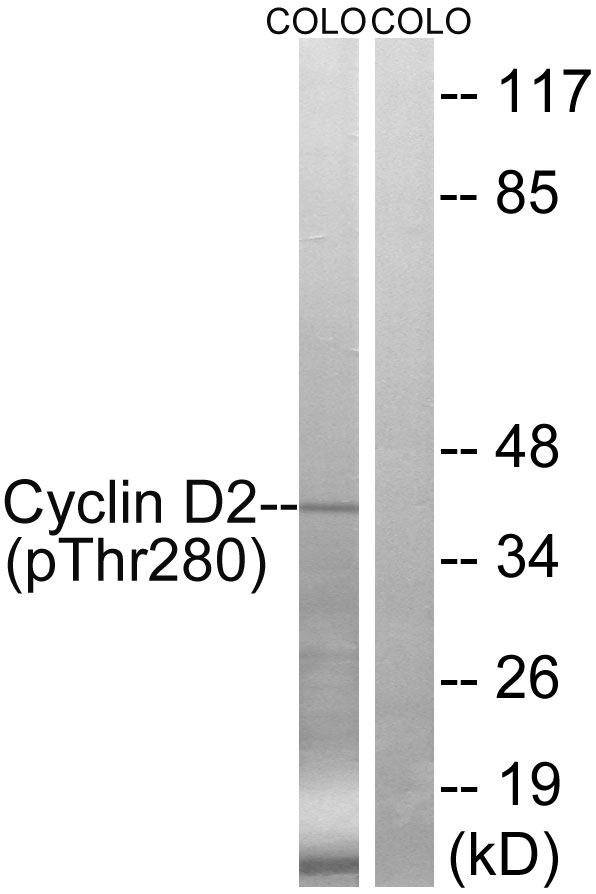 Cyclin D2 (Phospho-Thr280) Antibody