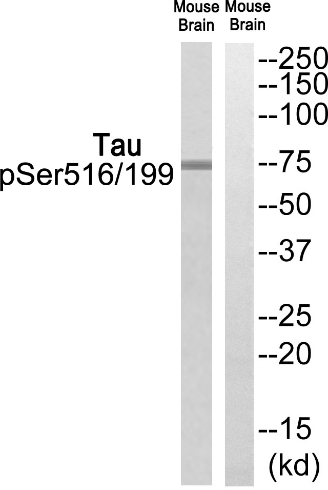 Tau (Phospho-Ser516/199) Antibody