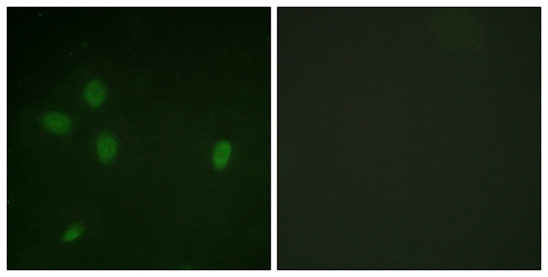 53BP1 (Phospho-Ser25) Antibody