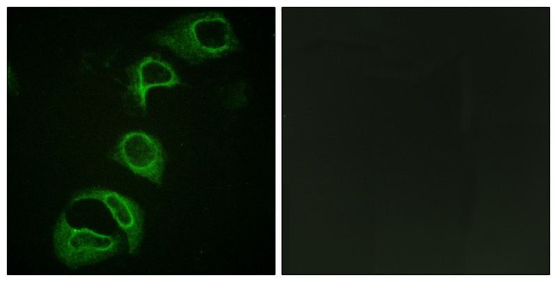 ALK (Phospho-Tyr1604) Antibody