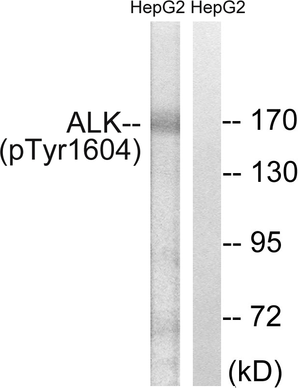 ALK (Phospho-Tyr1604) Antibody