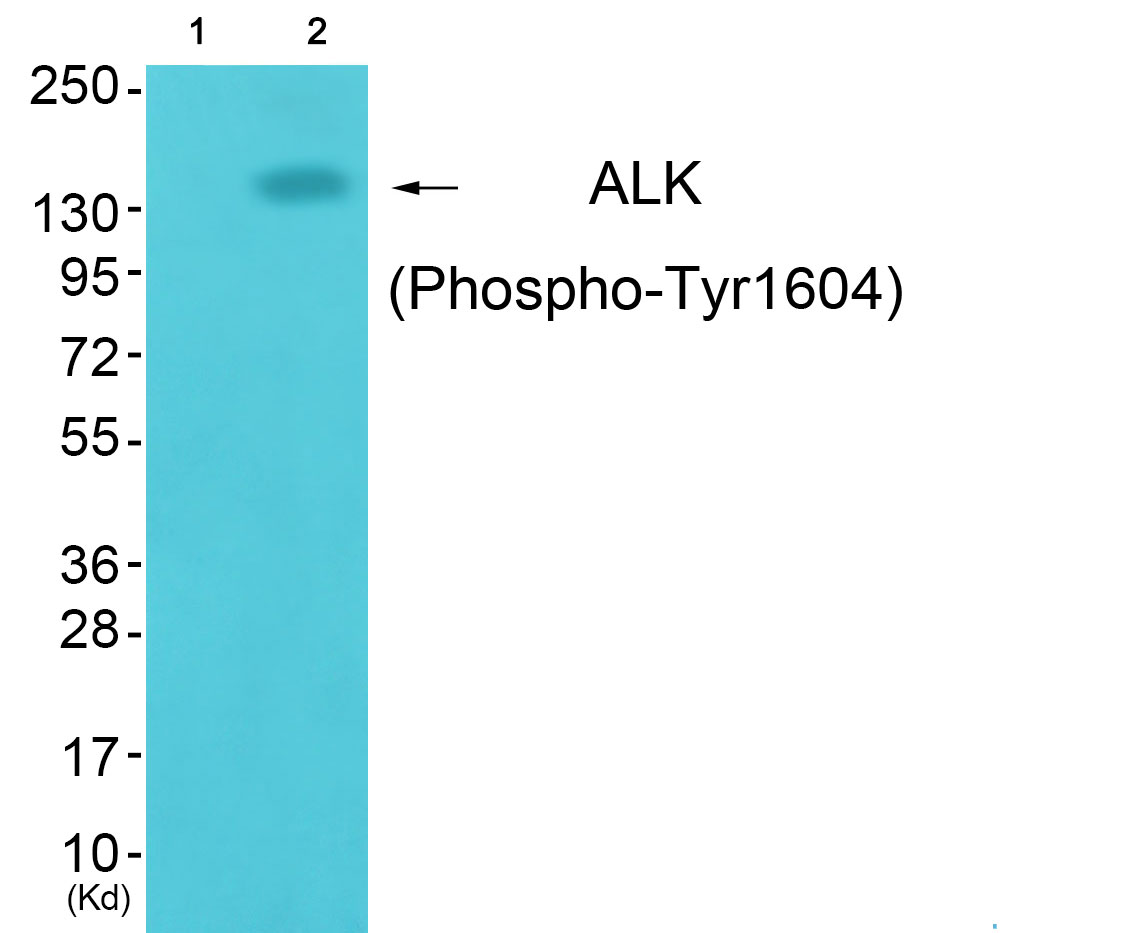 ALK (Phospho-Tyr1604) Antibody