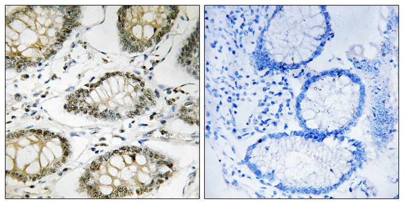 ATR (Phospho-Ser428) Antibody