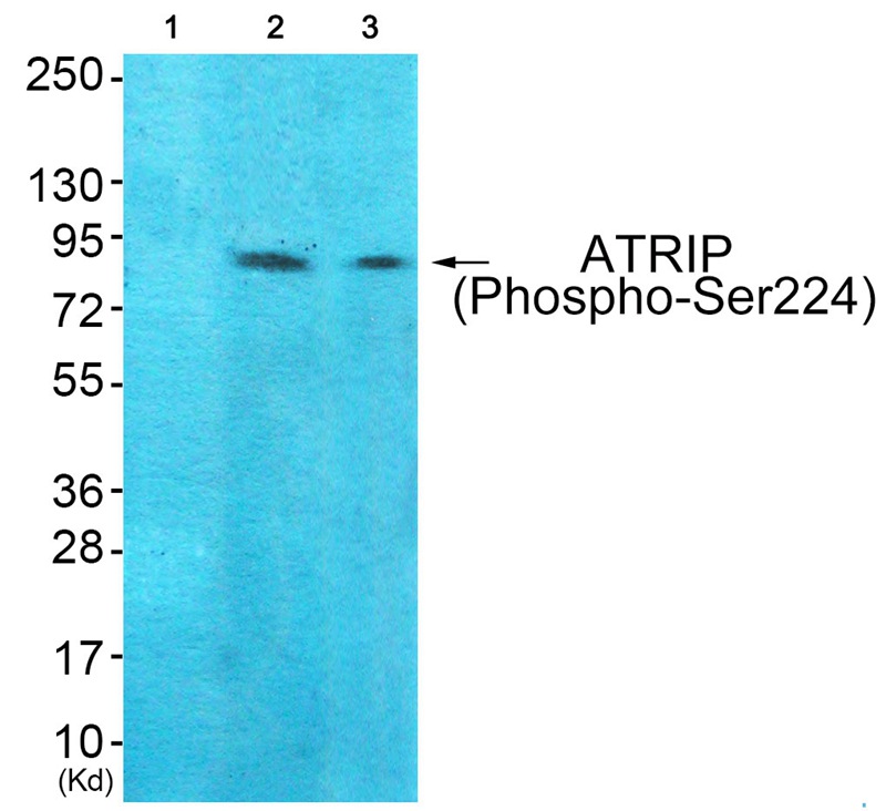 ATRIP (Phospho-Ser224) Antibody