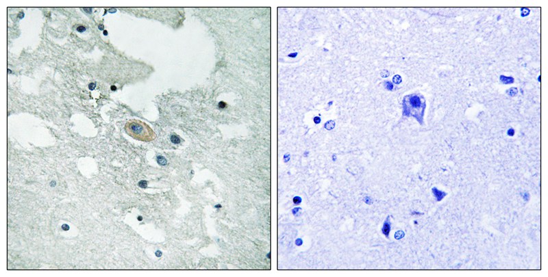 BLNK (Phospho-Tyr84) Antibody