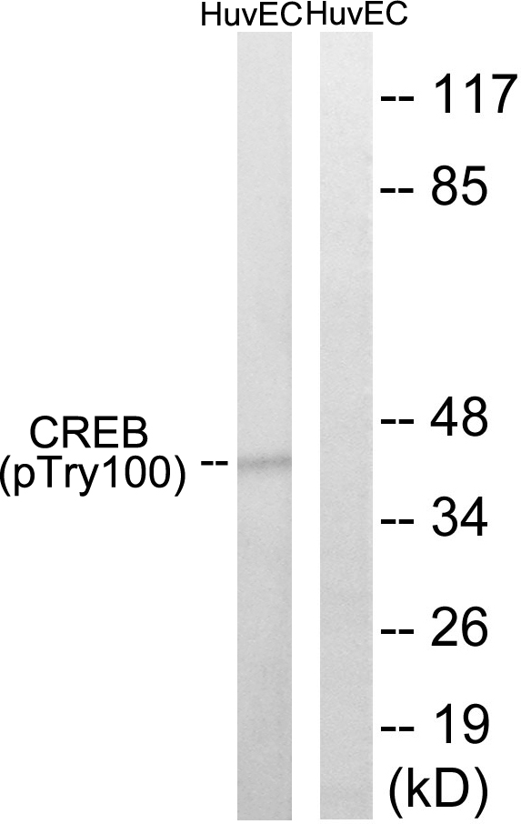 CREB (Phospho-Thr100) Antibody