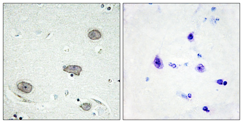 CSFR (Phospho-Tyr809) Antibody