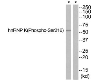 hnRNP K (Phospho-Ser216) Antibody