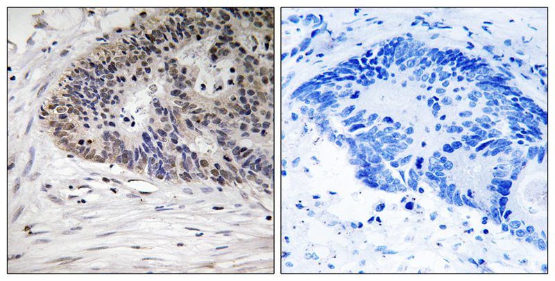 MDM4 (Phospho-Ser367) Antibody