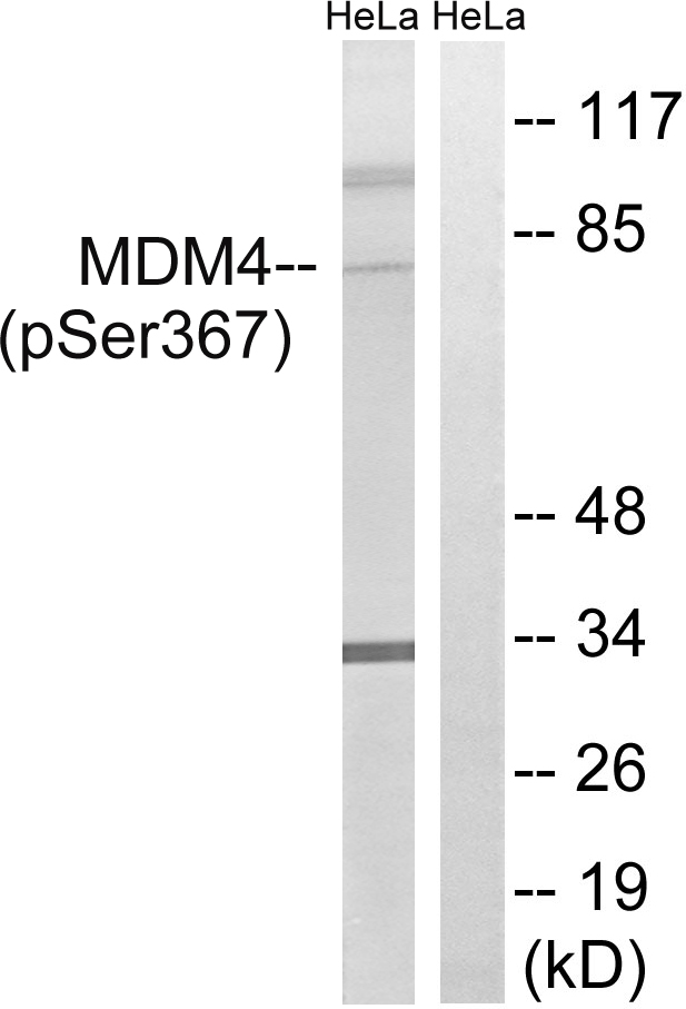 MDM4 (Phospho-Ser367) Antibody