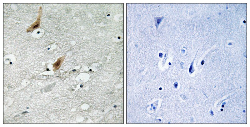 MSK2 (Phospho-Thr568) Antibody