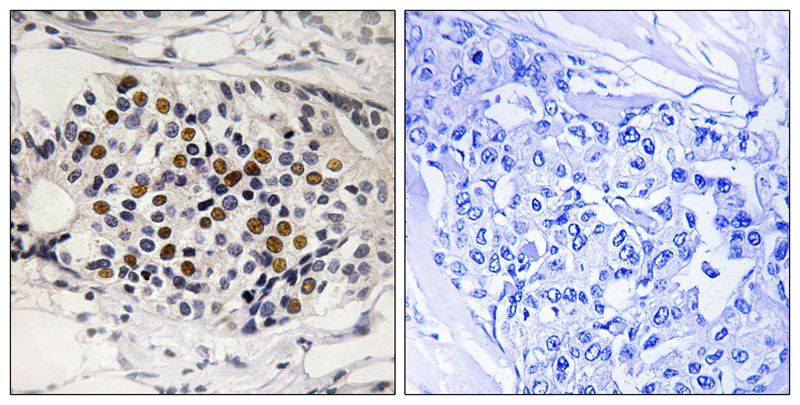 p16-INK4a (Phospho-Ser152) Antibody