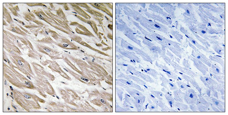 PPP1R2 (Phospho-Ser120/Ser121) Antibody