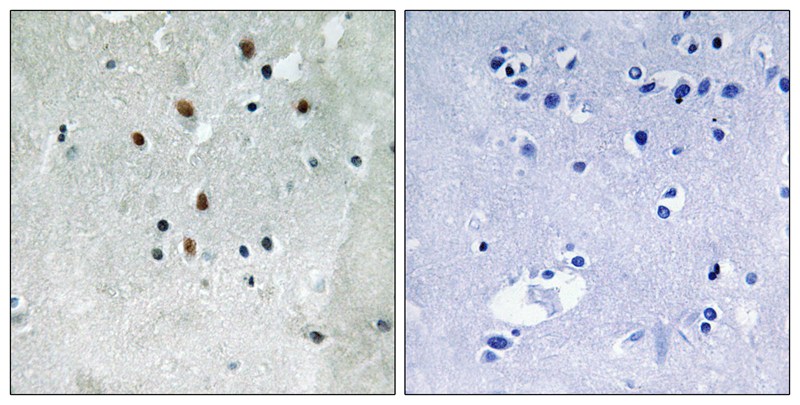 SRF (Phospho-Ser77) Antibody