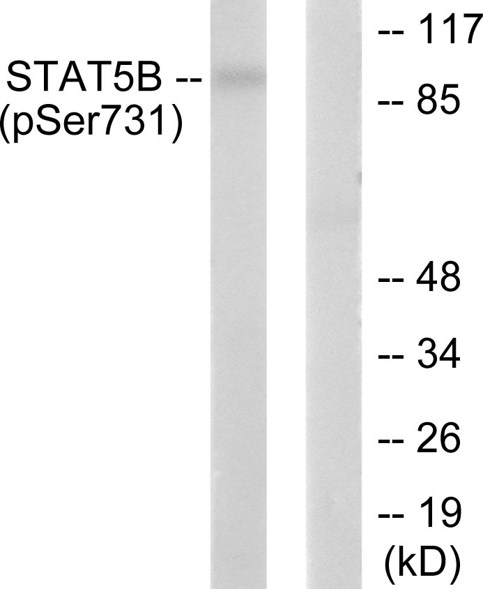 STAT5B (Phospho-Ser731) Antibody