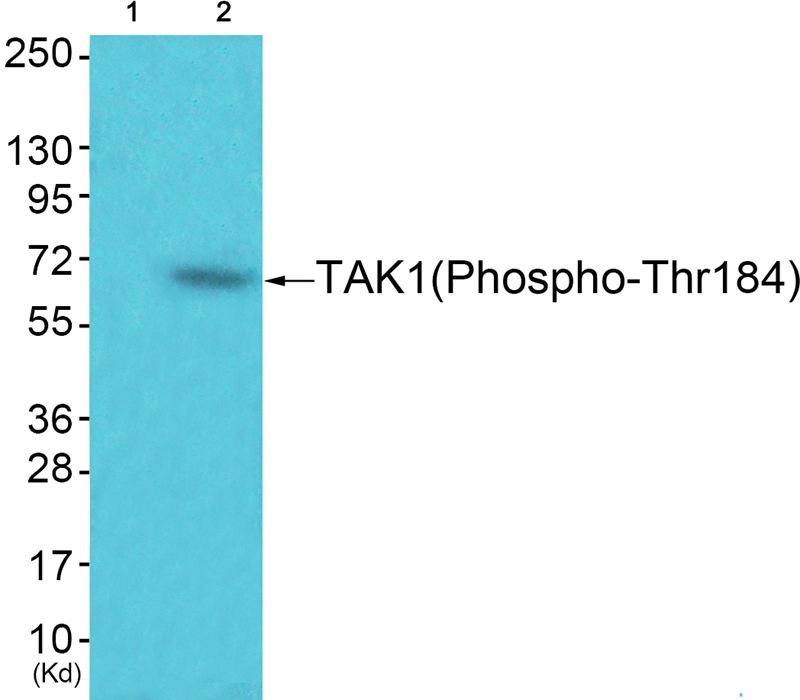 TAK1 (Phospho-Thr184) Antibody