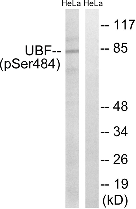 UBF (Phospho-Ser484) Antibody 