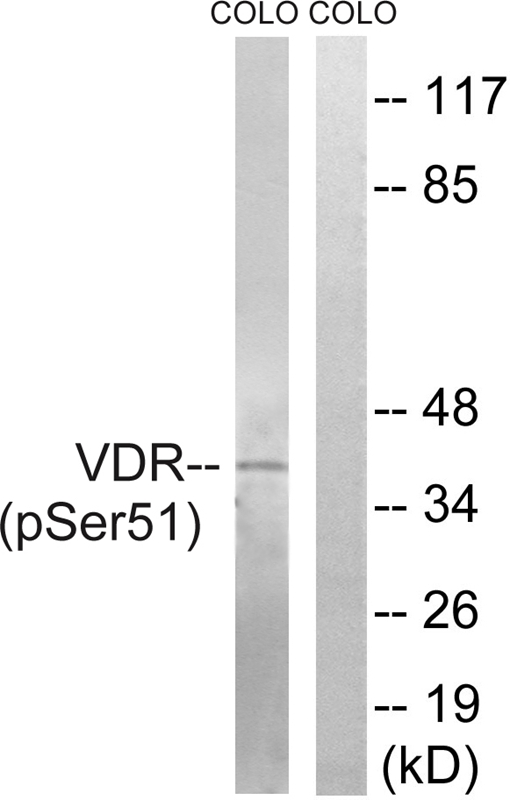 Vitamin D3 Receptor (Phospho-Ser51) Antibody