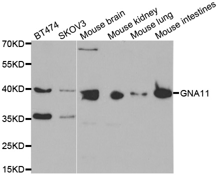 GNA11 antibody