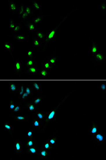 PARP1 antibody