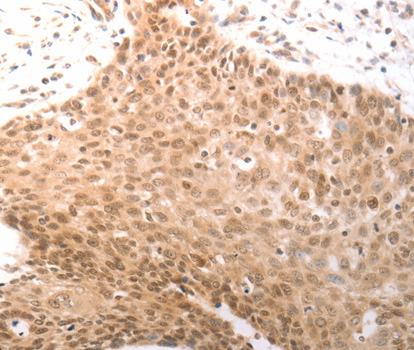 PARP1 antibody