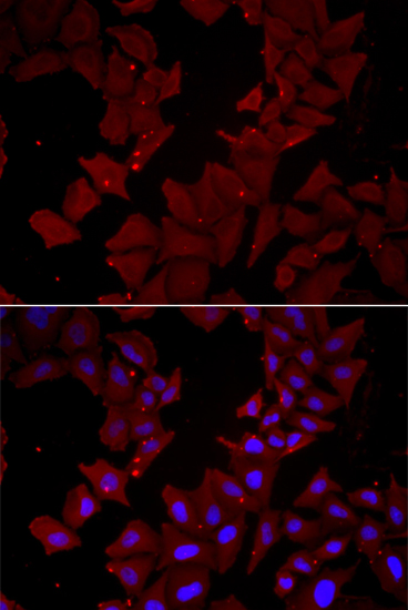 CCT4 antibody