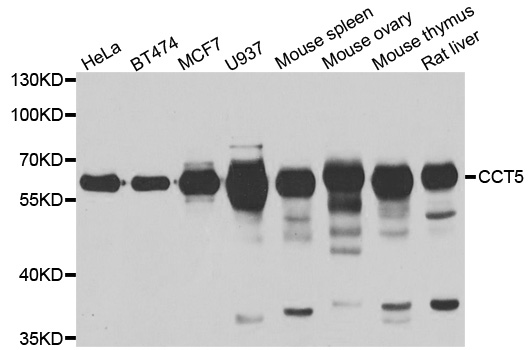 CCT5 antibody