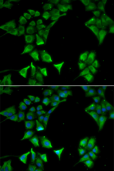 CD177 antibody