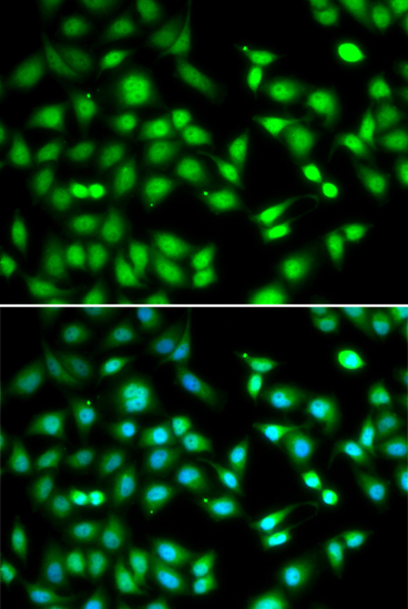 CDKN2D antibody