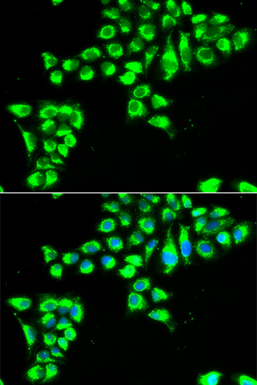 CLDN2 antibody